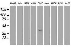 Image no. 1 for anti-Musashi Homolog 1 (Drosophila) (MSI1) antibody (ABIN1499571) (MSI1 antibody)
