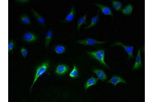 Immunofluorescent analysis of A549 cells using ABIN7170191 at dilution of 1:100 and Alexa Fluor 488-congugated AffiniPure Goat Anti-Rabbit IgG(H+L) (SLC25A36 antibody  (AA 58-110))