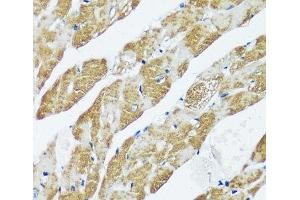 Immunohistochemistry of paraffin-embedded Mouse heart using CASQ2 Polyclonal Antibody at dilution of 1:100 (40x lens).