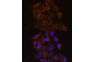Immunofluorescence analysis of C6 cells using UPF1/RENT1 Rabbit mAb (ABIN7271226) at dilution of 1:100 (40x lens). (RENT1/UPF1 antibody)