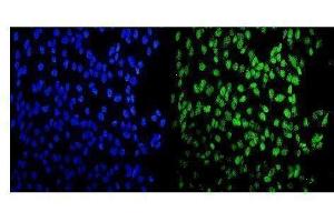 anti-Myocyte Enhancer Factor 2A (MEF2A) (AA 466-507), (C-Term) antibody