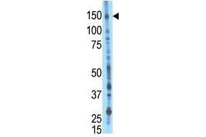 Image no. 1 for anti-BMP2 Inducible Kinase (BMP2K) (Middle Region) antibody (ABIN357190) (BMP2K antibody  (Middle Region))