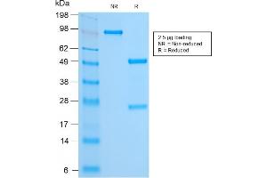 SDS-PAGE (SDS) image for anti-Forkhead Box A1 (FOXA1) (AA 372-472) antibody (ABIN6939657)