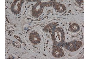 Immunohistochemical staining of paraffin-embedded breast using anti-CPA1 (ABIN2452540) mouse monoclonal antibody. (CPA1 antibody  (AA 1-419))