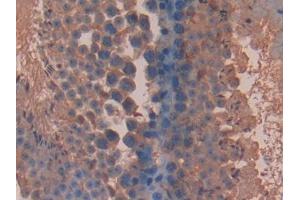 DAB staining on IHC-P; Samples: Mouse Testis Tissue (BLMH antibody  (AA 27-164))