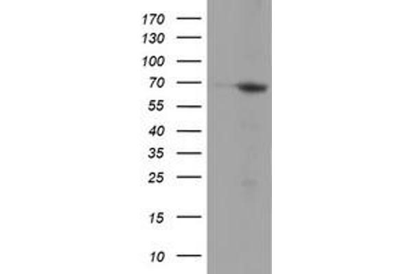 NMT2 antibody