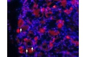Expression of TrkA in rat DRG - Immunohistochemical staining of rat dorsal root ganglia (DRG) frozen sections using Anti-TrkA (extracellular) Antibody (ABIN7043385, ABIN7044771 and ABIN7044772), (1:100). (TRKA antibody  (2nd Extracellular Domain))