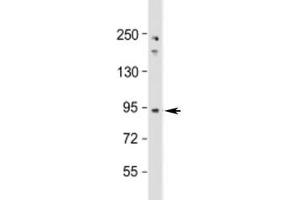 Western blot testing of human Jurkat cell lysate with NUP93 antibody at 1:1000.