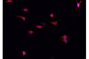 ABIN6276877 staining HepG2? (Cathepsin K antibody  (N-Term))