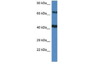 WB Suggested Anti-TNIP1 AntibodyTitration: 1. (TNIP1 antibody  (C-Term))