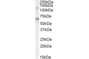 Image no. 1 for anti-Interleukin-1 Receptor-Associated Kinase 3 (IRAK3) (C-Term), (Internal Region) antibody (ABIN375025) (IRAK3 antibody  (C-Term, Internal Region))
