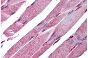 Human Skeletal Muscle (formalin-fixed, paraffin-embedded) stained with KALRN antibody ABIN213945 at 5 ug/ml followed by biotinylated goat anti-rabbit IgG secondary antibody ABIN481713, alkaline phosphatase-streptavidin and chromogen. (KALRN antibody  (AA 1591-1605))