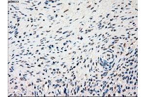Immunohistochemical staining of paraffin-embedded lung tissue using anti-SSBmouse monoclonal antibody. (SSB antibody)
