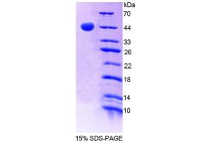 SDS-PAGE (SDS) image for Growth Hormone Releasing Hormone Receptor (GHRHR) (AA 23-130) protein (His tag,GST tag) (ABIN4989317)