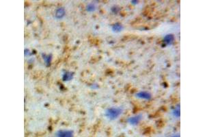 Used in DAB staining on fromalin fixed paraffin-embedded Brain tissue (GSTA4 antibody  (AA 3-222))