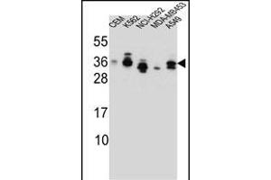 SSX4 Antibody (Center) (ABIN657137 and ABIN2837900) western blot analysis in CEM,K562,NCI-,MDA-M,A549 cell line lysates (35 μg/lane). (SSX4 antibody  (AA 63-91))