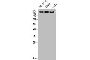 Western blot analysis of SH-SY5Y K562 HELA using RNase III Drosha antibody.