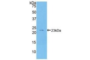 Western blot analysis of recombinant Human HSPb2. (HSPB2 antibody  (AA 12-182))