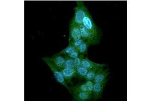 ICC/IF analysis of GSTT1 in HepG2 cells line, stained with DAPI (Blue) for nucleus staining and monoclonal anti-human GSTT1 antibody (1:100) with goat anti-mouse IgG-Alexa fluor 488 conjugate (Green). (GSTT1 antibody)