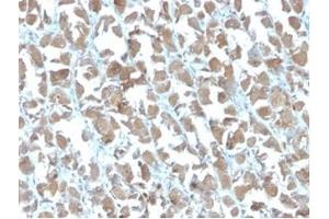 Formalin-fixed, paraffin-embedded human stomach stained with MICA Mouse Recombinant Monoclonal Antibody (MICA/4442). (MICA antibody  (AA 1-200))
