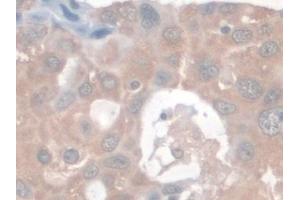 Immunohistochemistry (IHC) image for anti-Spectrin Repeat Containing, Nuclear Envelope 2 (SYNE2) (AA 6-296) antibody (ABIN7436189)