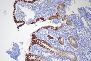 IHC analysis of Krt20 using anti-Krt20 antibody (ABIN7601133). (KRT20 antibody  (AA 29-431))