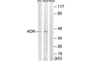 Western Blotting (WB) image for anti-Adenosine Kinase (ADK) (AA 1-50) antibody (ABIN2889523) (ADK antibody  (AA 1-50))