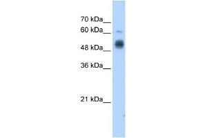 GCNT3 antibody used at 1. (GCNT3 antibody)