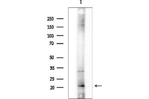 anti-Mitochondrial Ribosomal Protein S11 (MRPS11) (C-Term) antibody