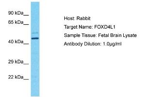 Host: Rabbit Target Name: FOXD4L1 Sample Tissue: Human Fetal Brain Antibody Dilution: 1ug/ml (FOXD4L1 antibody  (N-Term))