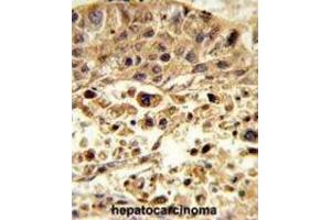 Immunohistochemistry (IHC) image for anti-Vacuolar Protein Sorting-Associated Protein 26A (VPS26A) antibody (ABIN3003886) (VPS26A antibody)
