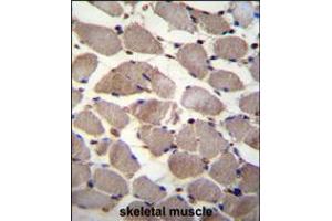 PIK3C2A Antibody immunohistochemistry analysis in formalin fixed and paraffin embedded human skeletal muscle followed by peroxidase conjugation of the secondary antibody and DAB staining. (PIK3C2A antibody  (C-Term))