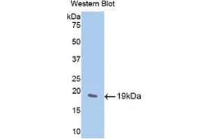 Western blot analysis of the recombinant protein. (WISP1 antibody  (AA 213-350))