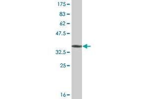 Western Blot detection against Immunogen (36. (COQ8A antibody  (AA 1-100))