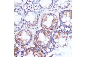 Immunohistochemistry of paraffin-embedded human colon using Collagen X/COL10 Rabbit pAb (8604) at dilution of 1:100 (40x lens). (COL10A1 antibody)