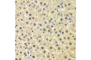 Immunohistochemistry of paraffin-embedded rat liver using SPHK1 Antibody (ABIN5970017) at dilution of 1/100 (40x lens). (SPHK1 antibody)