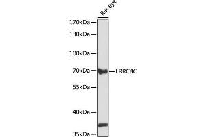 Western blot analysis of extracts of rat eye, using LRRC4C antibody (ABIN7268218) at 1:1000 dilution. (LRRC4C antibody  (AA 450-520))