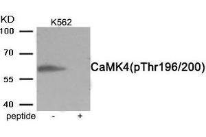 Western blot analysis of extracts from K562 cells treated with H2O2 using Phospho-CaMK4 (Thr196/200) antibody. (CAMK4 antibody  (pThr196, pThr200))