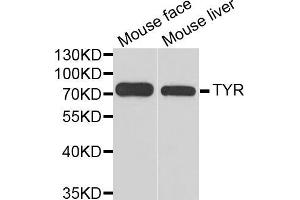 Western blot analysis of extracts of various cell lines, using TYR antibody (ABIN5970593) at 1/1000 dilution. (TYR antibody)