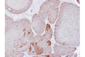 IHC-P Image Immunohistochemical analysis of paraffin-embedded Cal27 xenograft, using Proteasome 26S S3, antibody at 1:500 dilution. (Proteasome 26S S3 (Center) antibody)