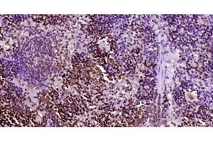 Paraformaldehyde-fixed, paraffin embedded Mouse spleen, Antigen retrieval by boiling in sodium citrate buffer (pH6. (NK-1.1/CD161c antibody  (AA 101-200))