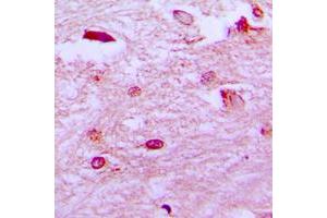Immunohistochemical analysis of ETV1 staining in human brain formalin fixed paraffin embedded tissue section. (ETV1 antibody  (N-Term))