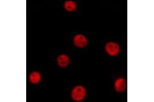 ABIN6277089 staining  Hela cells by IF/ICC. (PIN1 antibody  (N-Term))
