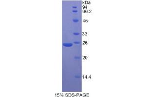 SDS-PAGE analysis of Rat MYH8 Protein. (MYH8 Protein)