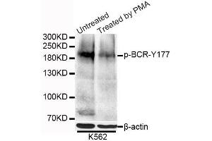 Western blot analysis of extracts of K-562 cells, using Phospho-BCR-Y177 antibody (ABIN5995631) at 1/1000 dilution. (BCR antibody  (pTyr177))