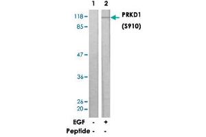 Western blot analysis of extracts from A431 cells, untreated or treated with EGF (200ng/ml, 10min), using PRKD1 (phospho S910) polyclonal antibody . (PKC mu antibody  (pSer910))
