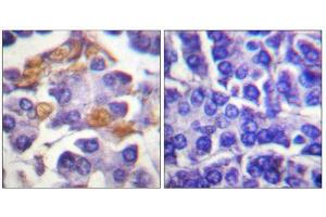 Immunohistochemistry (IHC) image for anti-V-Raf-1 Murine Leukemia Viral Oncogene Homolog 1 (RAF1) (pTyr341) antibody (ABIN1847298) (RAF1 antibody  (pTyr341))