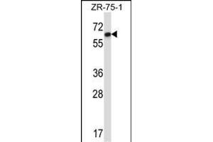 DCTN4 Antibody (N-term) (ABIN657377 and ABIN2846423) western blot analysis in ZR-75-1 cell line lysates (35 μg/lane). (Dynactin 4 antibody  (N-Term))