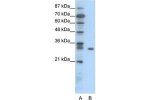 Western Blotting (WB) image for anti-NF-kappa-B inhibitor beta (NFKBIB) antibody (ABIN2460933) (NFKBIB antibody)