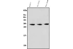 Western blot analysis of BCMA/Tnfrsf17 using anti-BCMA/Tnfrsf17 antibody (ABIN7603163).